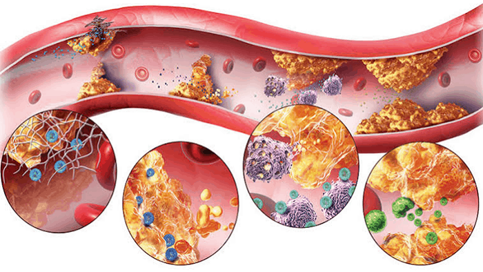 Effects Of Saturated Fat In The Body