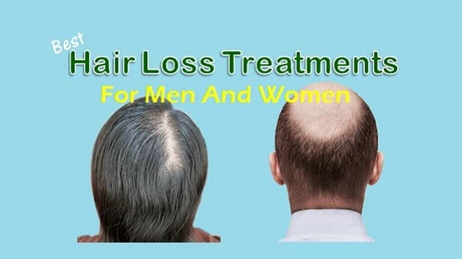 Hair Loss Treatment