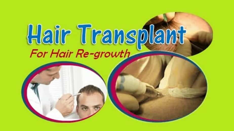 Hair Transplant For Hair Regrowth