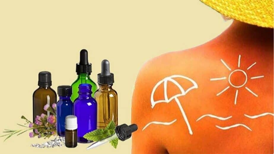 Essential Oils For Sunburn