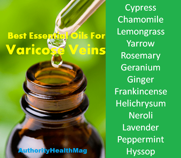 Best Essential Oils For Varicose Veins 