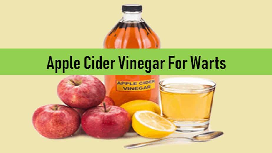 Apple Cider Vinegar For Warts