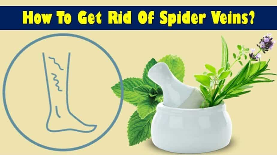 How To Get Rid Of Spider Veins