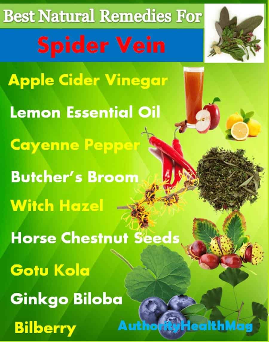 Best Natural Remedies for Spider Veins