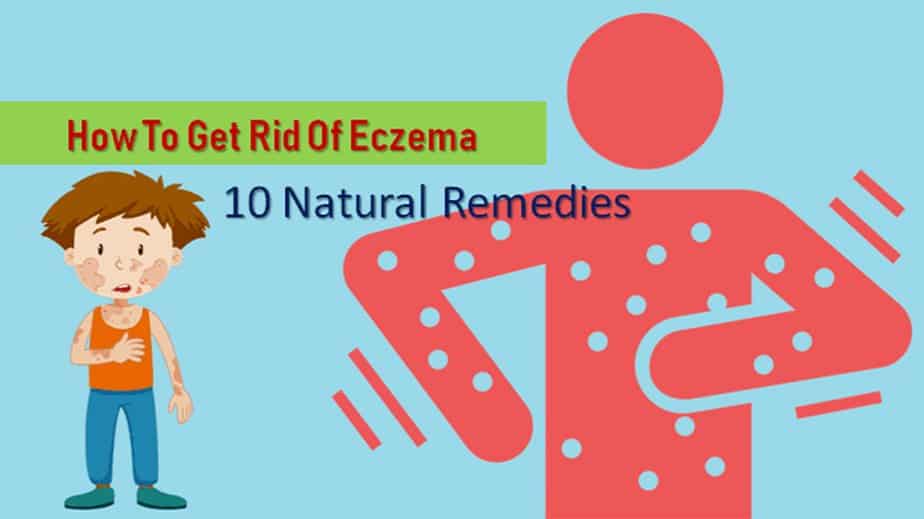 Ways To Get Rid Of Eczema