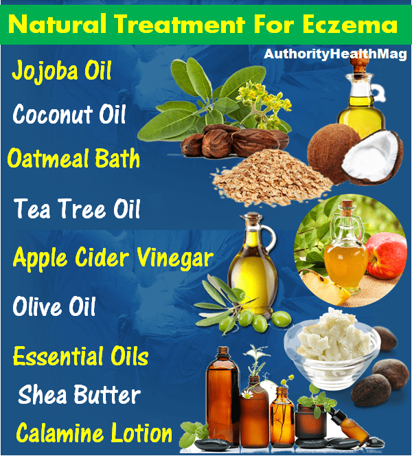 natural treatment for eczema