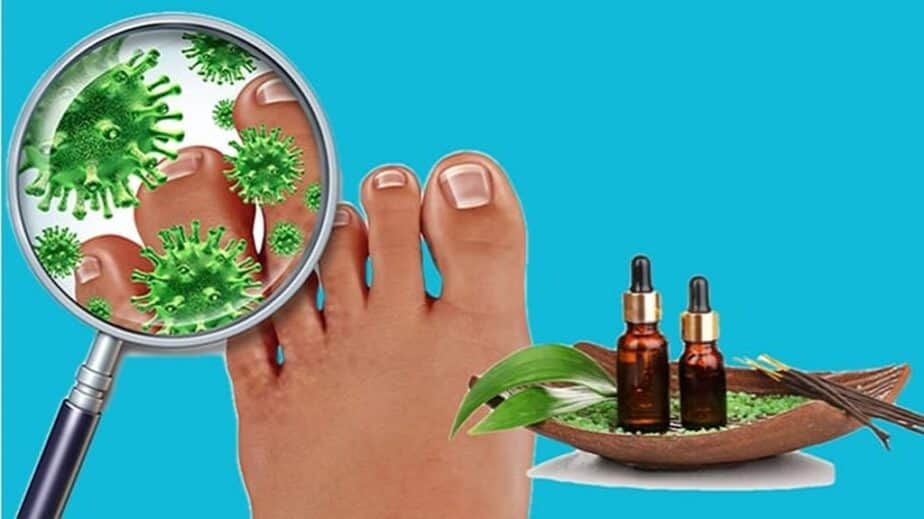 Essential Oils For Toenail Fungus