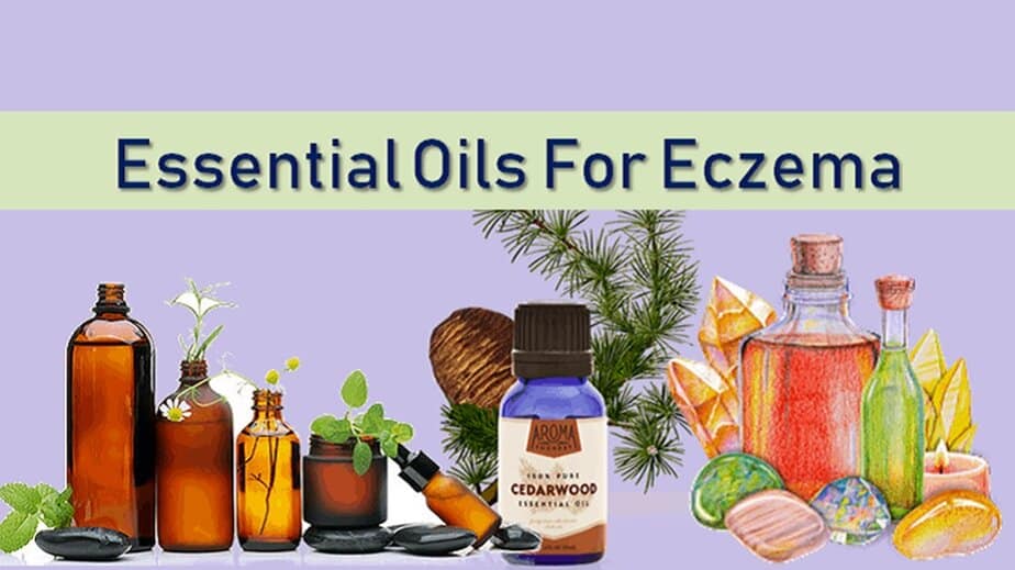 Best Essential Oils For Eczema