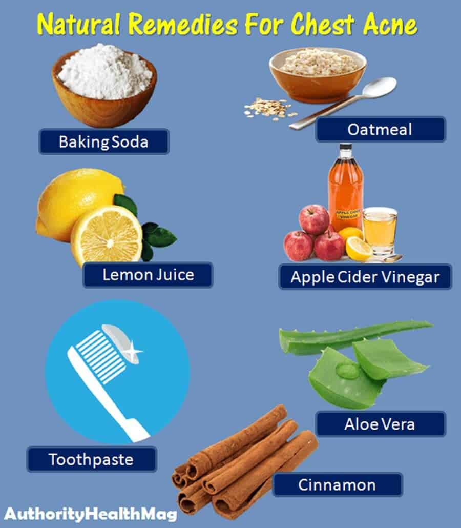 Home Remedies For Chest Acne
