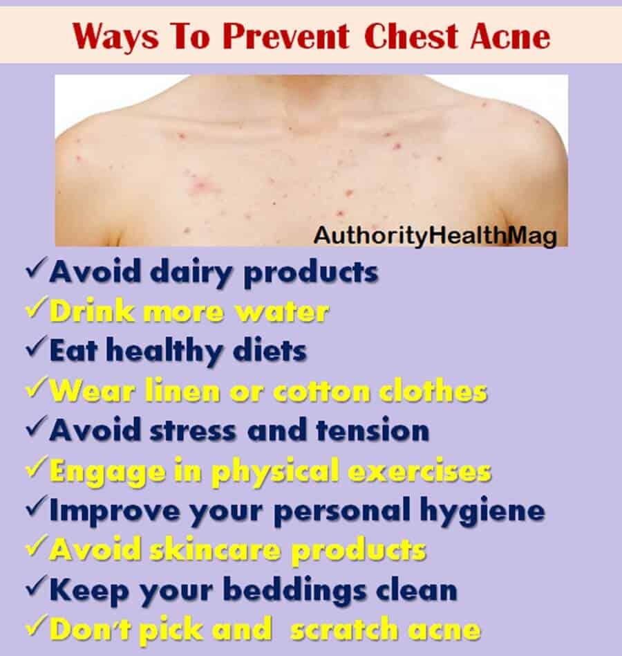 Ways To Prevent Chest Acne