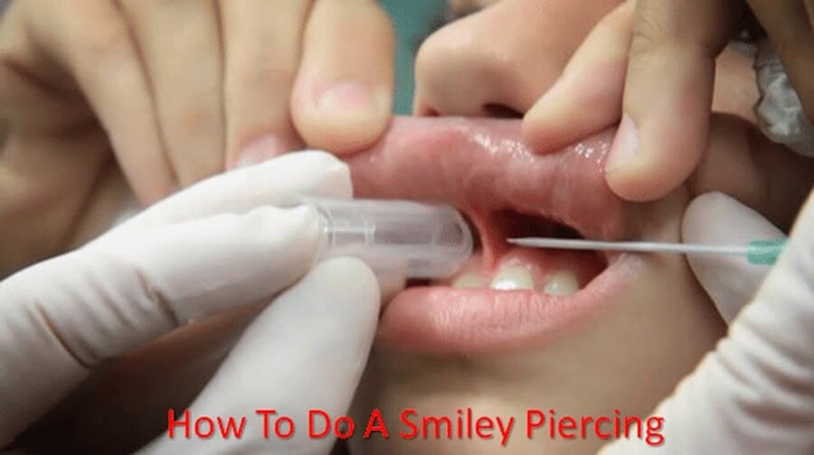 How to Do Smiley Piercing