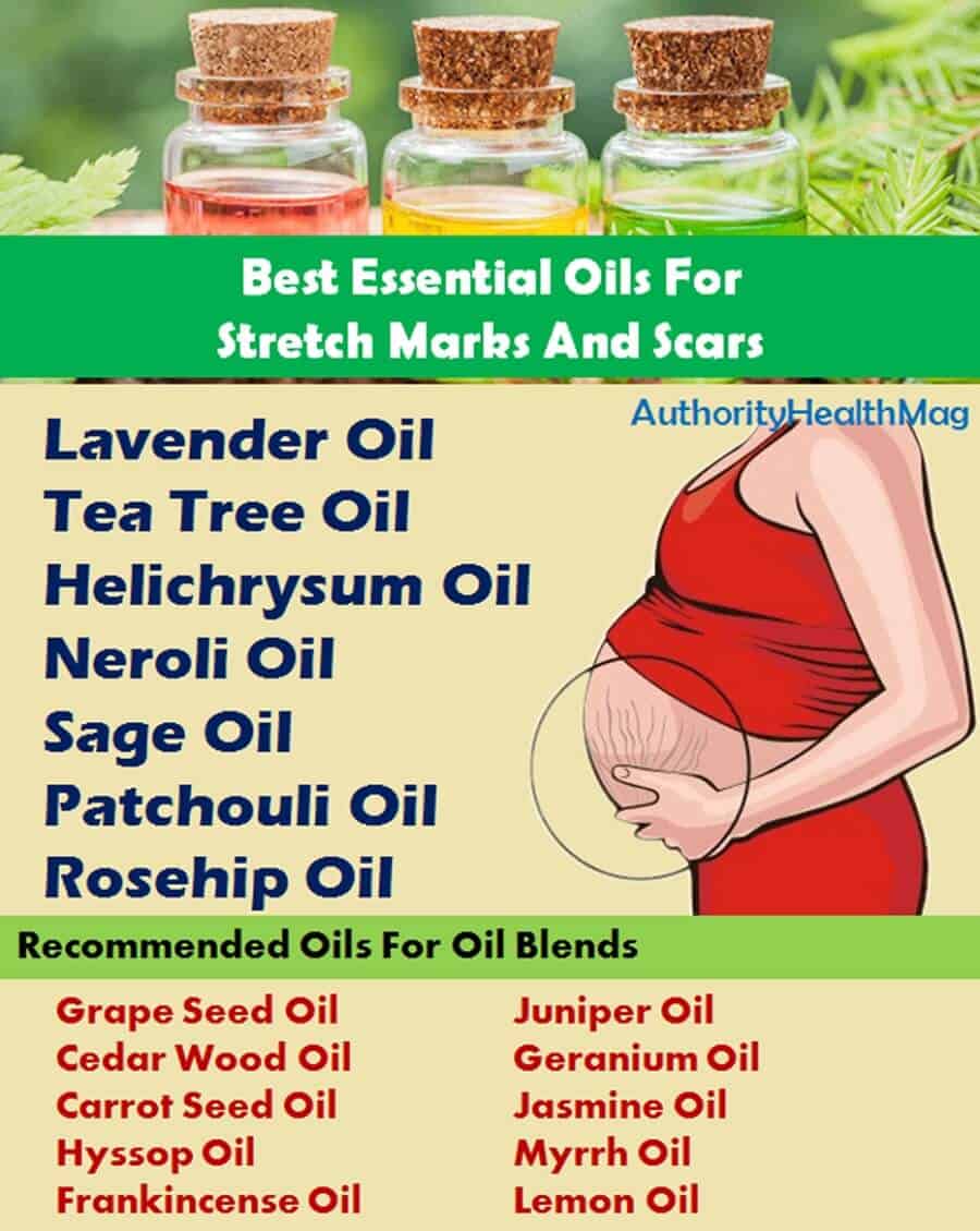 Essential Oils for Stretch Marks and Scars Removal