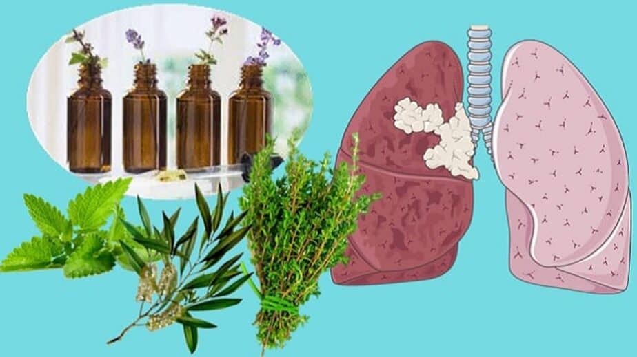 Essential Oils For Bronchitis