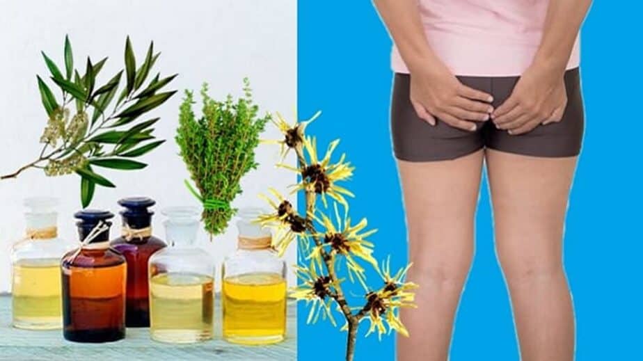 Essential Oils For Hemorrhoids