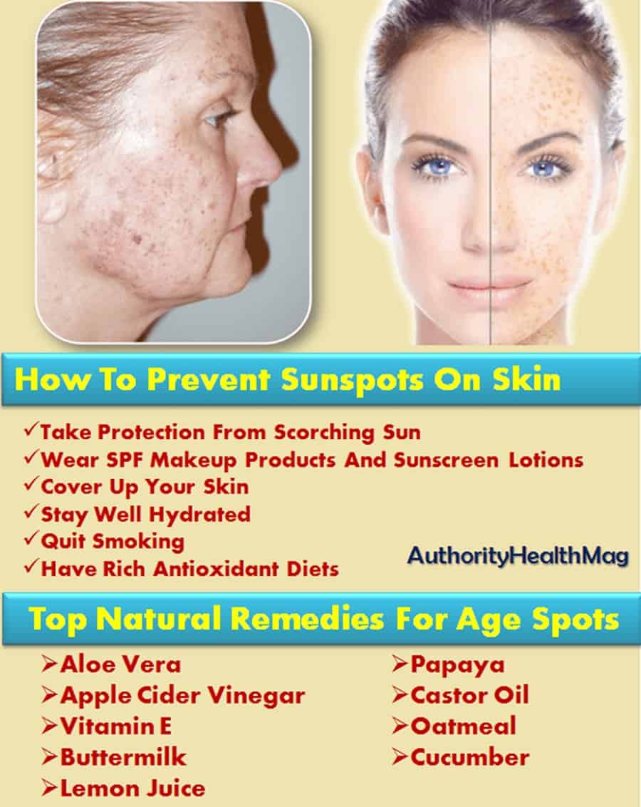 Sunspots On Skin And Face Sunspot Removal Remedies 