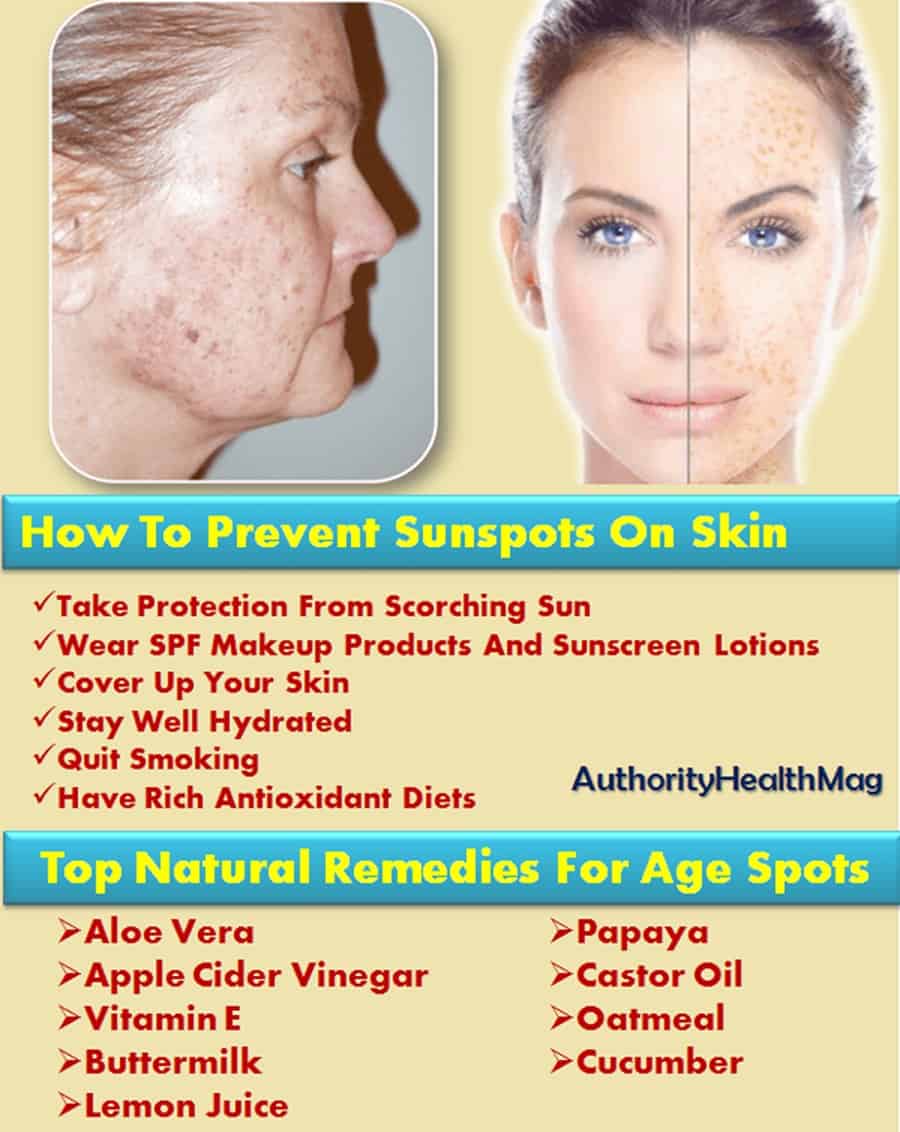 Sunspots On Skin And Face Sunspot Removal Remedies