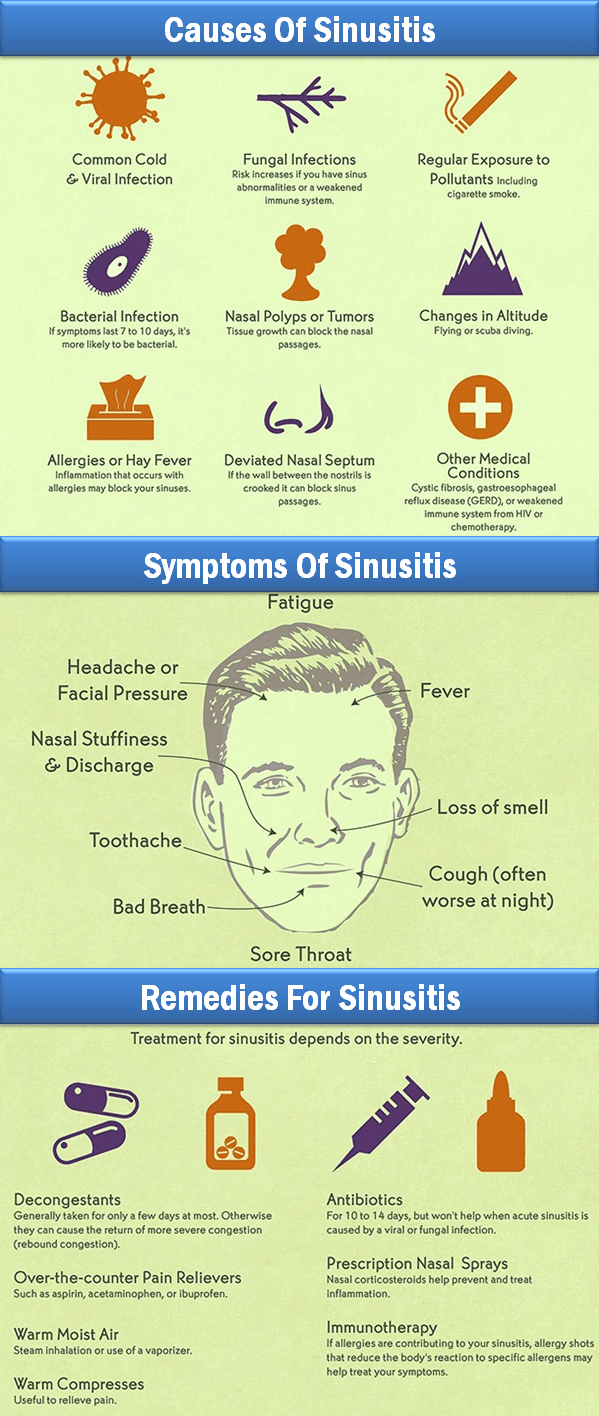 Sinus Facts