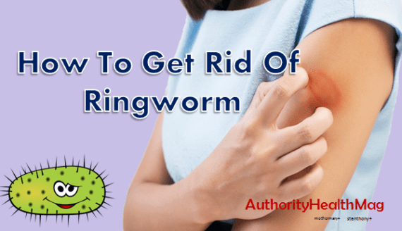 how to get rid of ringworm cream