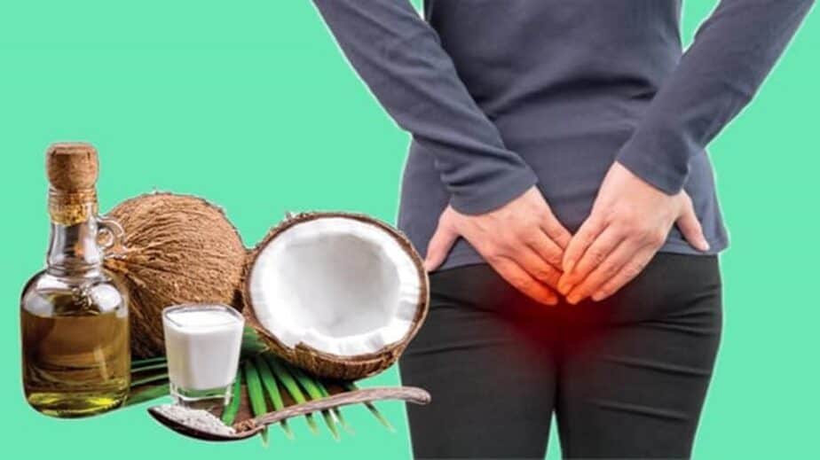 Coconut Oil For Hemorrhoids