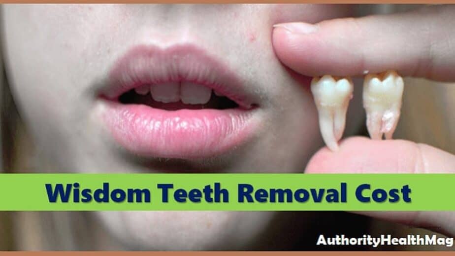 Wisdom Teeth Removal Cost