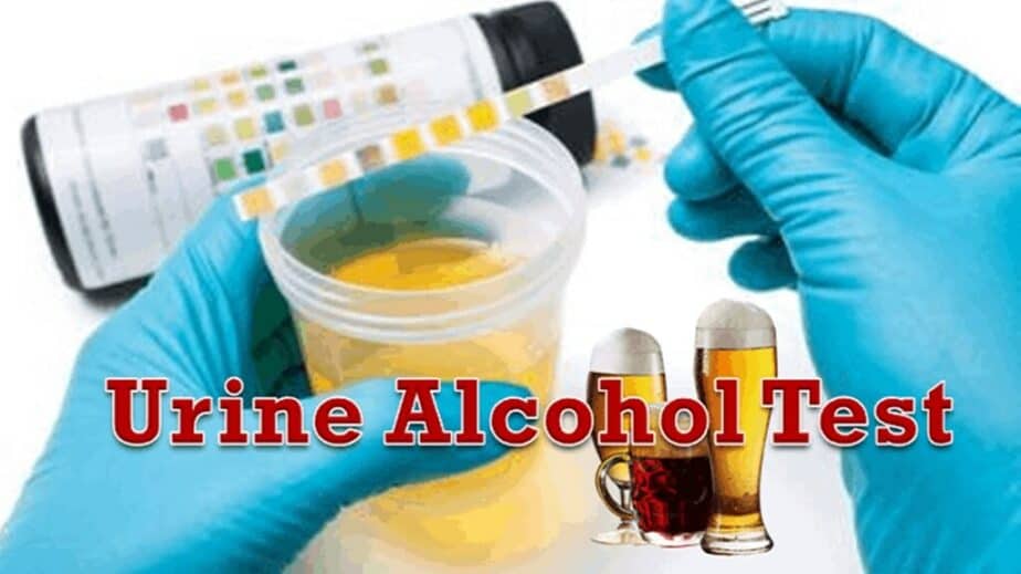 Alcohol Urine Test