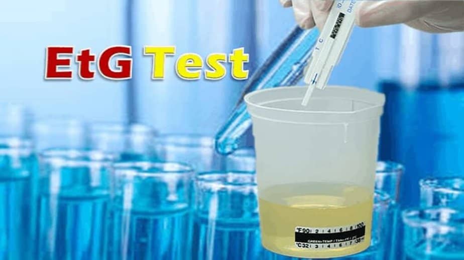 EtG Alcohol Test