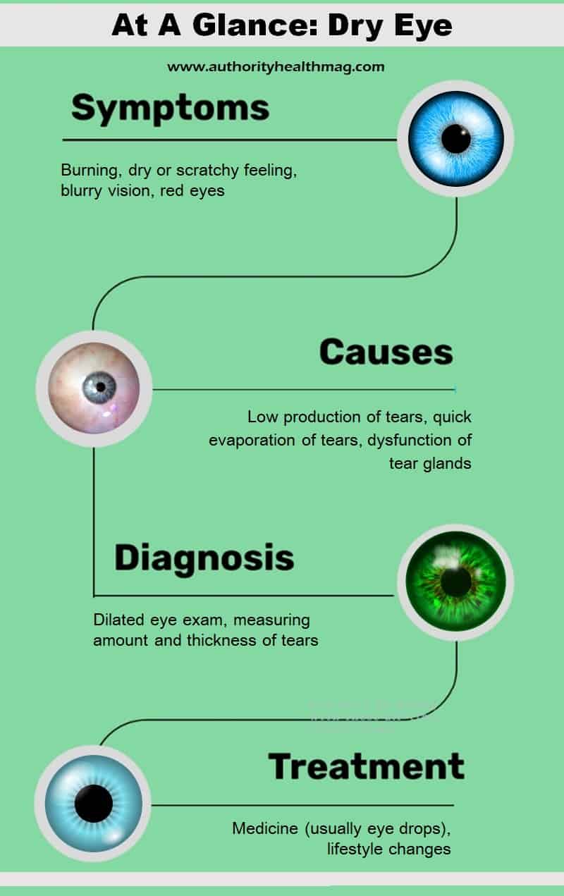 Dry Eyes: A Brief Overview 